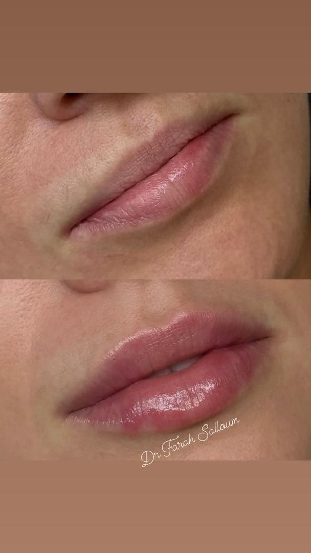 صورة منشأة NAYA BEAUTY - قسم مراكز إزالة الشعر بالليزر في Jdeidet Artouz 1