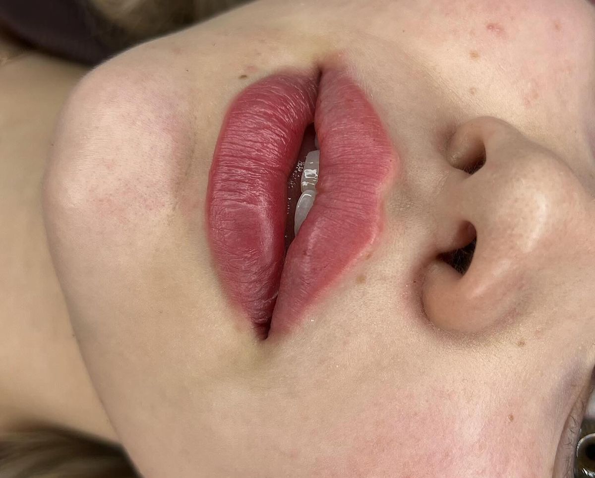 صورة منشأة Dr.dimaalali - قسم دكتور أنف أذن حنجرة (ENT) في Dummar 3