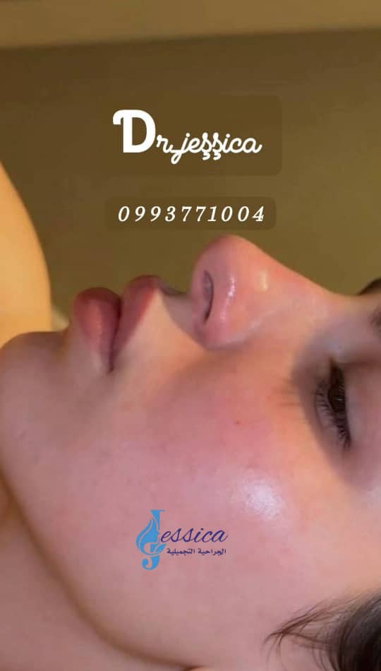 صورة منشأة عيادة جيسيكا التجميلية - قسم عيادات تجميل جراحي في Jaramana 1