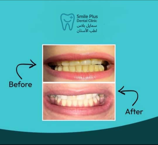 صورة منشأة Smile Plus / د. حازم نفيسة_د.تميم مردم بك - قسم دكتور أسنان في Jdeidet Artouz 2
