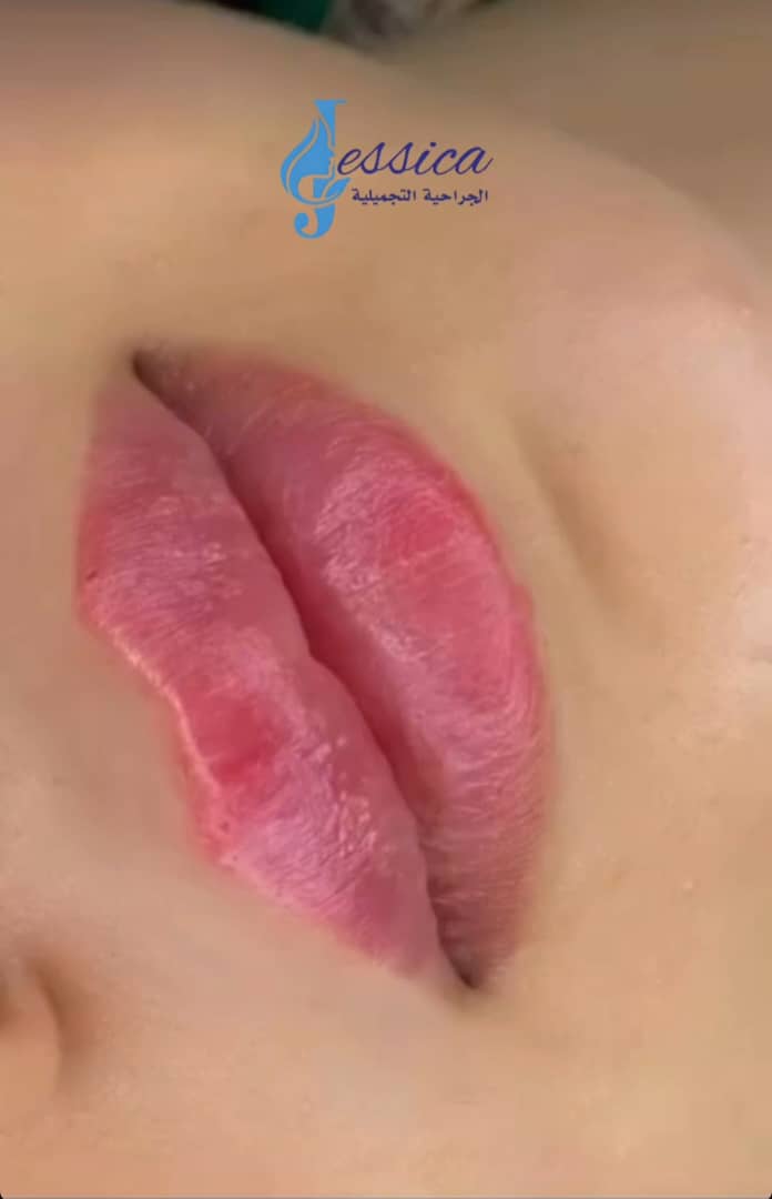 صورة منشأة عيادة جيسيكا التجميلية - قسم عيادات تجميل جراحي في Jaramana 4