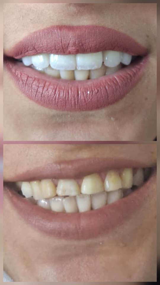 صورة منشأة Harmony Dental clinic - قسم دكتور أسنان في Jdeidet Artouz 5