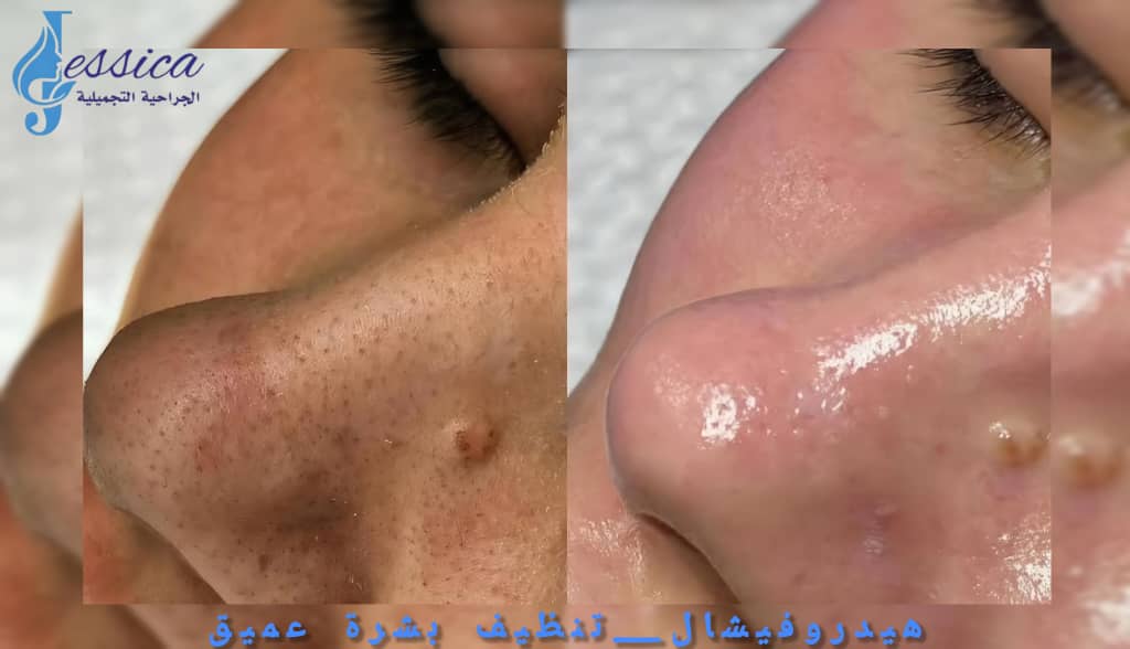 صورة منشأة عيادة جيسيكا التجميلية - قسم عيادات تجميل جراحي في Jaramana 6