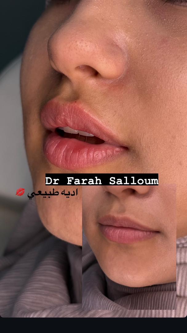 صورة منشأة NAYA BEAUTY - قسم مراكز إزالة الشعر بالليزر في Jdeidet Artouz 4