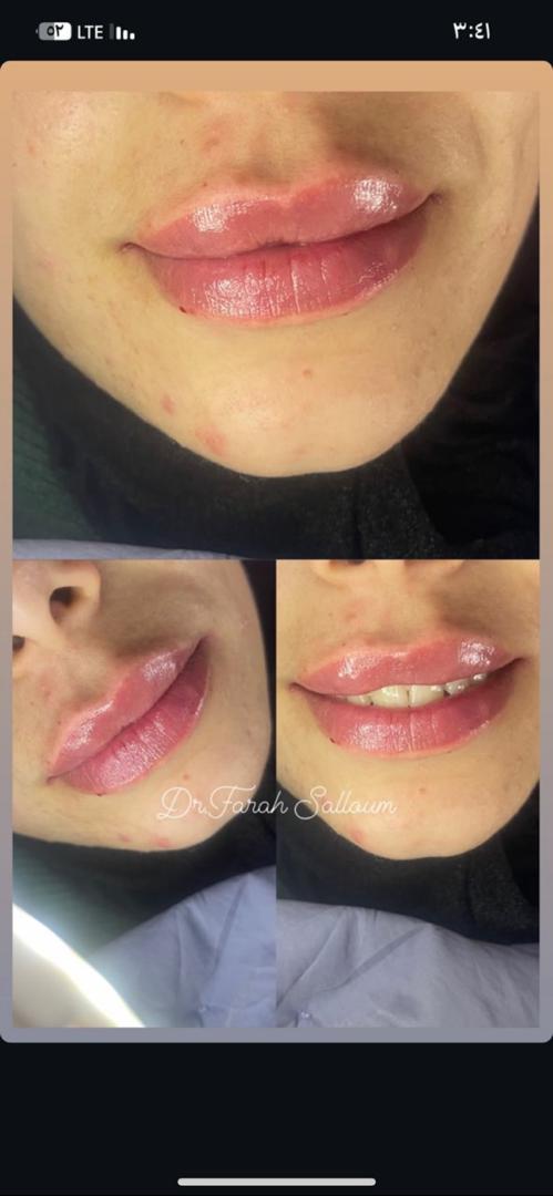 صورة منشأة NAYA BEAUTY - قسم مراكز إزالة الشعر بالليزر في Jdeidet Artouz 3