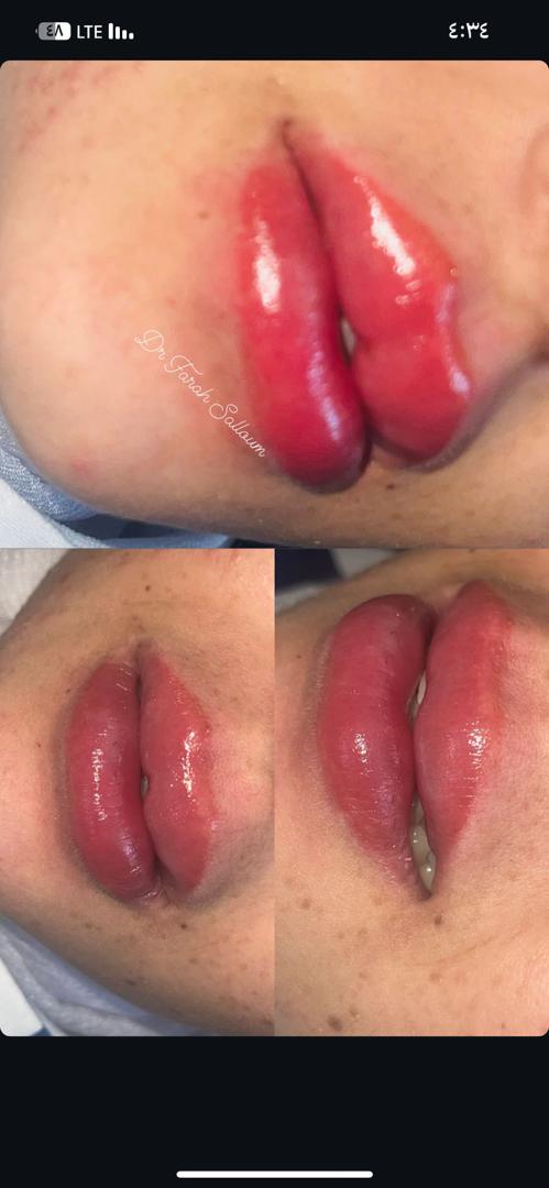 صورة منشأة NAYA BEAUTY - قسم مراكز إزالة الشعر بالليزر في Jdeidet Artouz 2