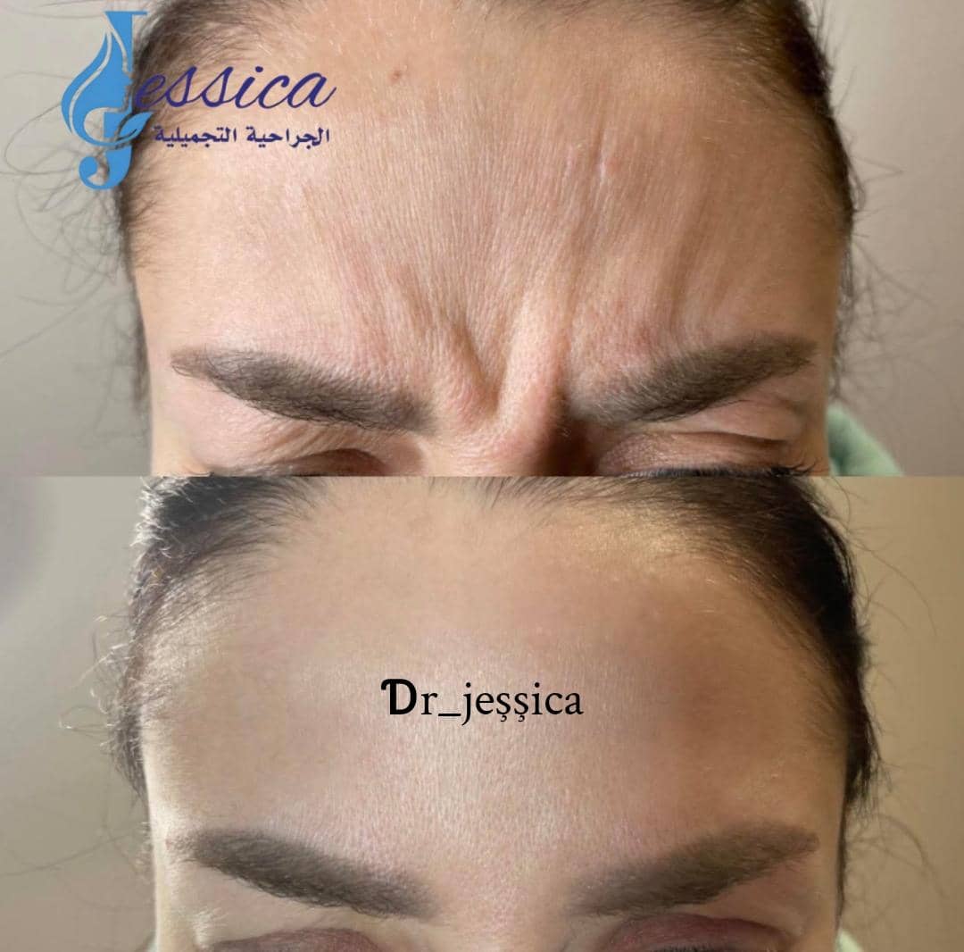 صورة منشأة عيادة جيسيكا التجميلية - قسم عيادات تجميل جراحي في Jaramana 5