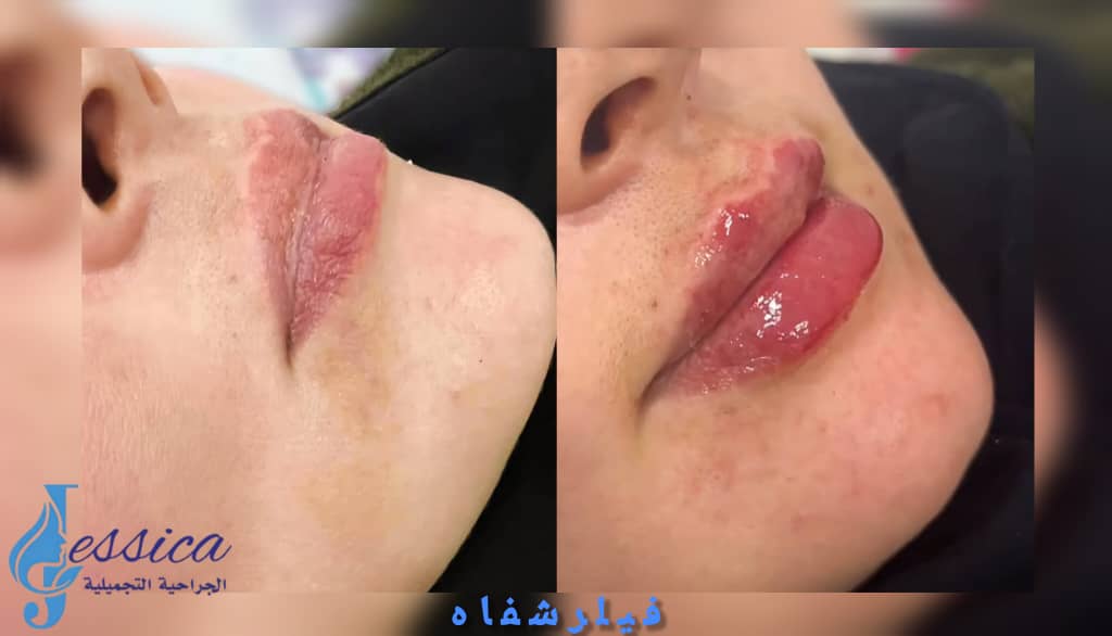 صورة منشأة عيادة جيسيكا التجميلية - قسم عيادات تجميل جراحي في Jaramana 7