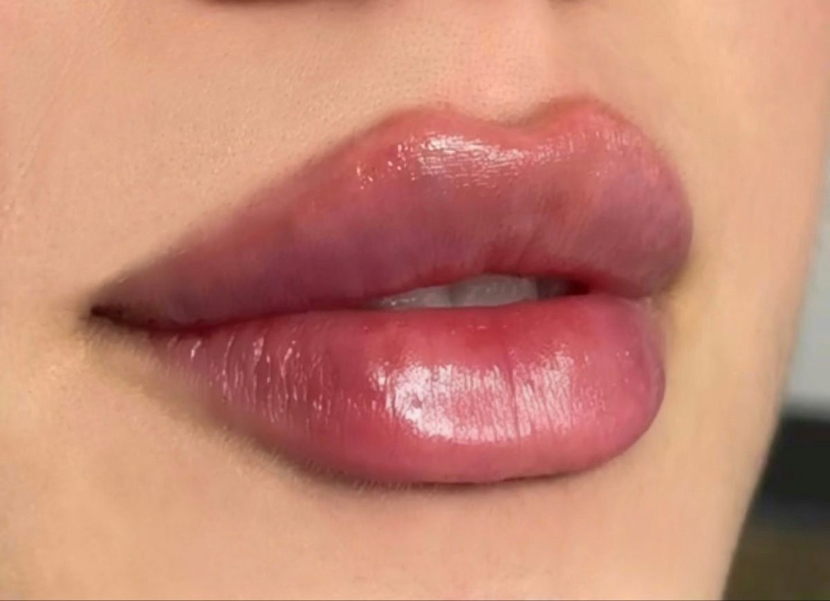 صورة منشأة Dr.dimaalali - قسم دكتور أنف أذن حنجرة (ENT) في Dummar 6