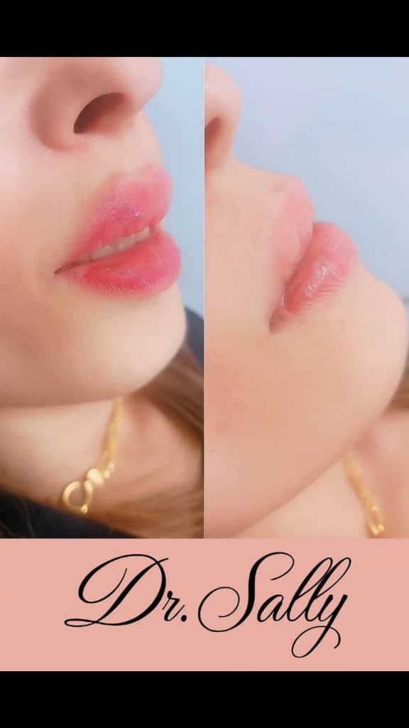 صورة منشأة Ofelia Beauty Clinic - قسم مراكز إزالة الشعر بالليزر في Jdeidet Artouz 3