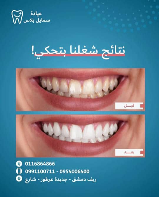 صورة منشأة Smile Plus / د. حازم نفيسة_د.تميم مردم بك - قسم دكتور أسنان في Jdeidet Artouz 1