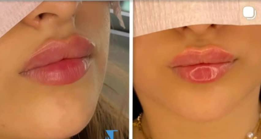 صورة منشأة عيادة جيسيكا التجميلية - قسم عيادات تجميل جراحي في Jaramana 9