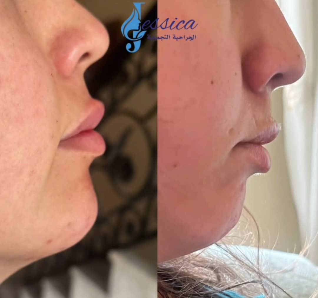 صورة منشأة عيادة جيسيكا التجميلية - قسم عيادات تجميل جراحي في Jaramana 3