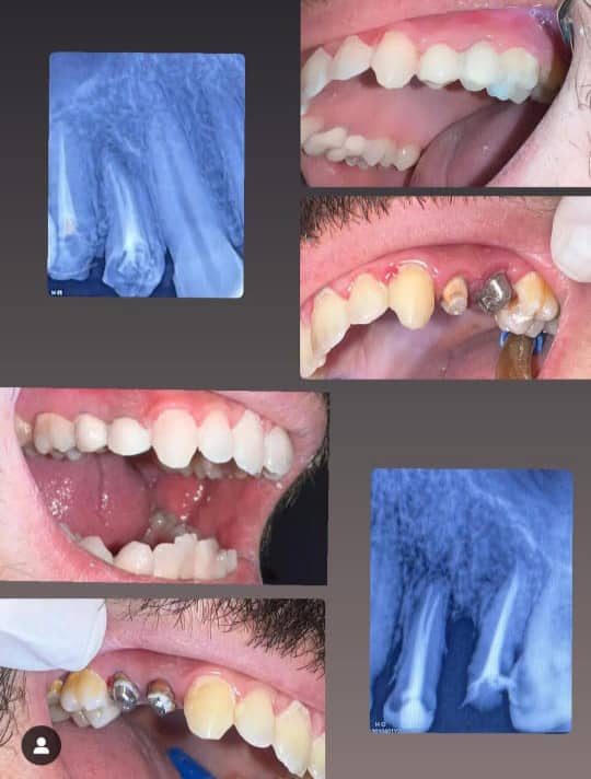 صورة منشأة Smile Plus / د. حازم نفيسة_د.تميم مردم بك - قسم دكتور أسنان في Jdeidet Artouz 3