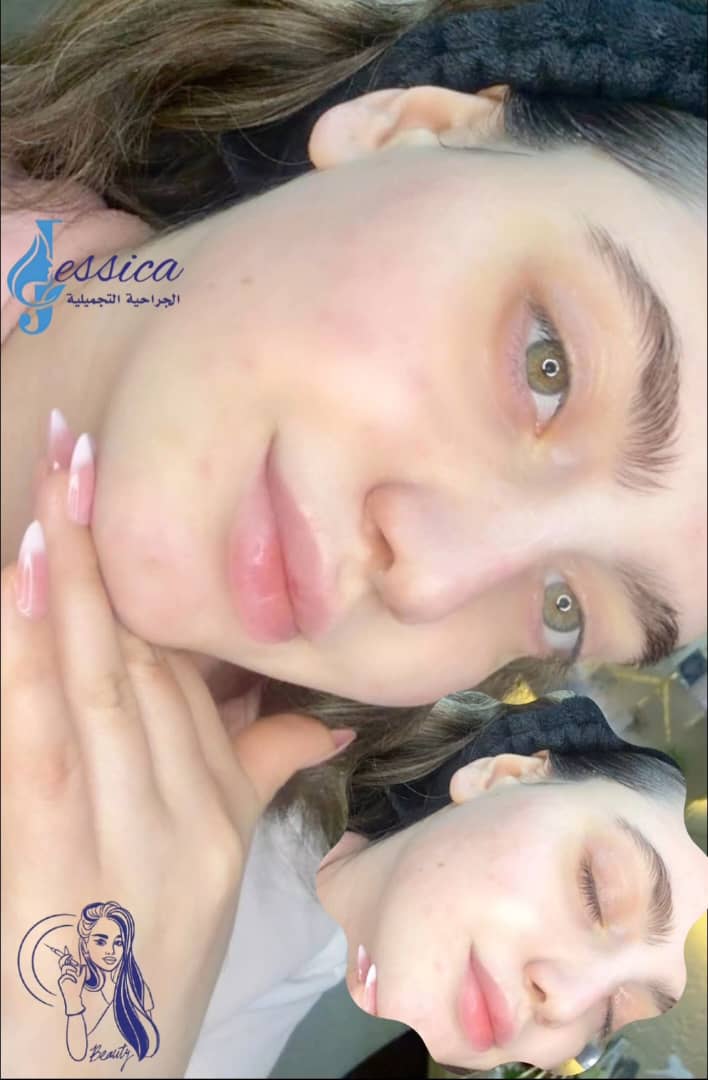 صورة منشأة عيادة جيسيكا التجميلية - قسم عيادات تجميل جراحي في Jaramana 8